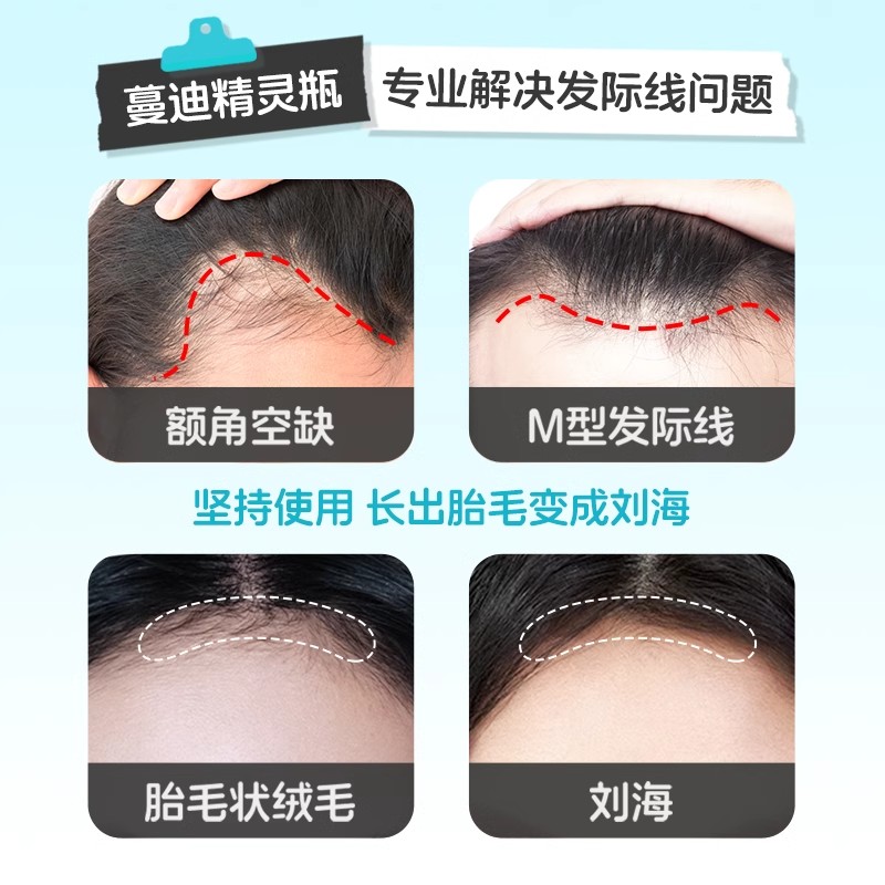 蔓迪精灵瓶米诺地尔酊男女性生发液脱发发际线增长曼迪官方旗舰店