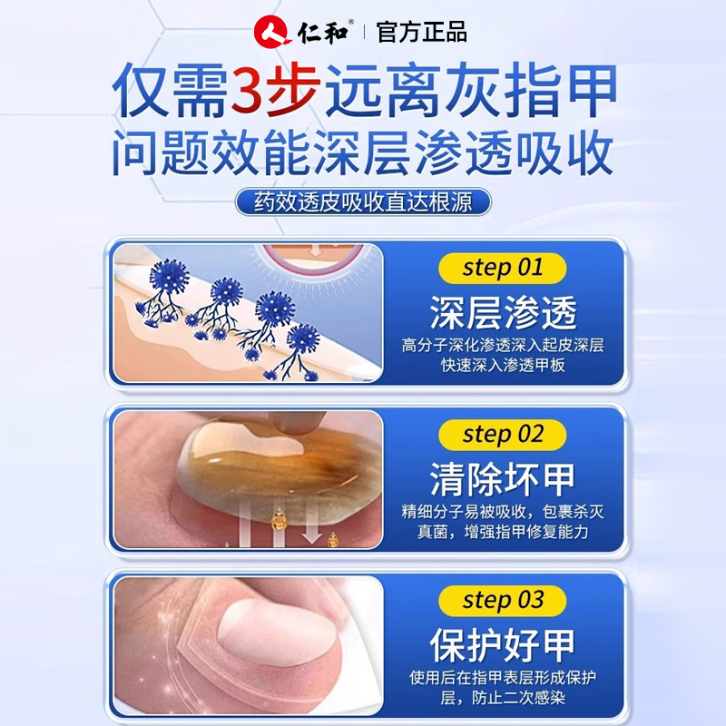 仁和医用灰指甲专用药强效去灰甲脚指甲变色浑浊修复亮甲专用