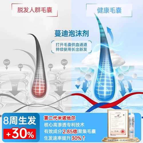 Второе поколение агента пенообразования Minoxidil Mandison для мужчин Alopecia areata встречается в официальном флагманском магазине Mandie