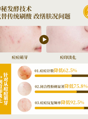 灭痘精华调理敏感毛孔粗大油痘肌