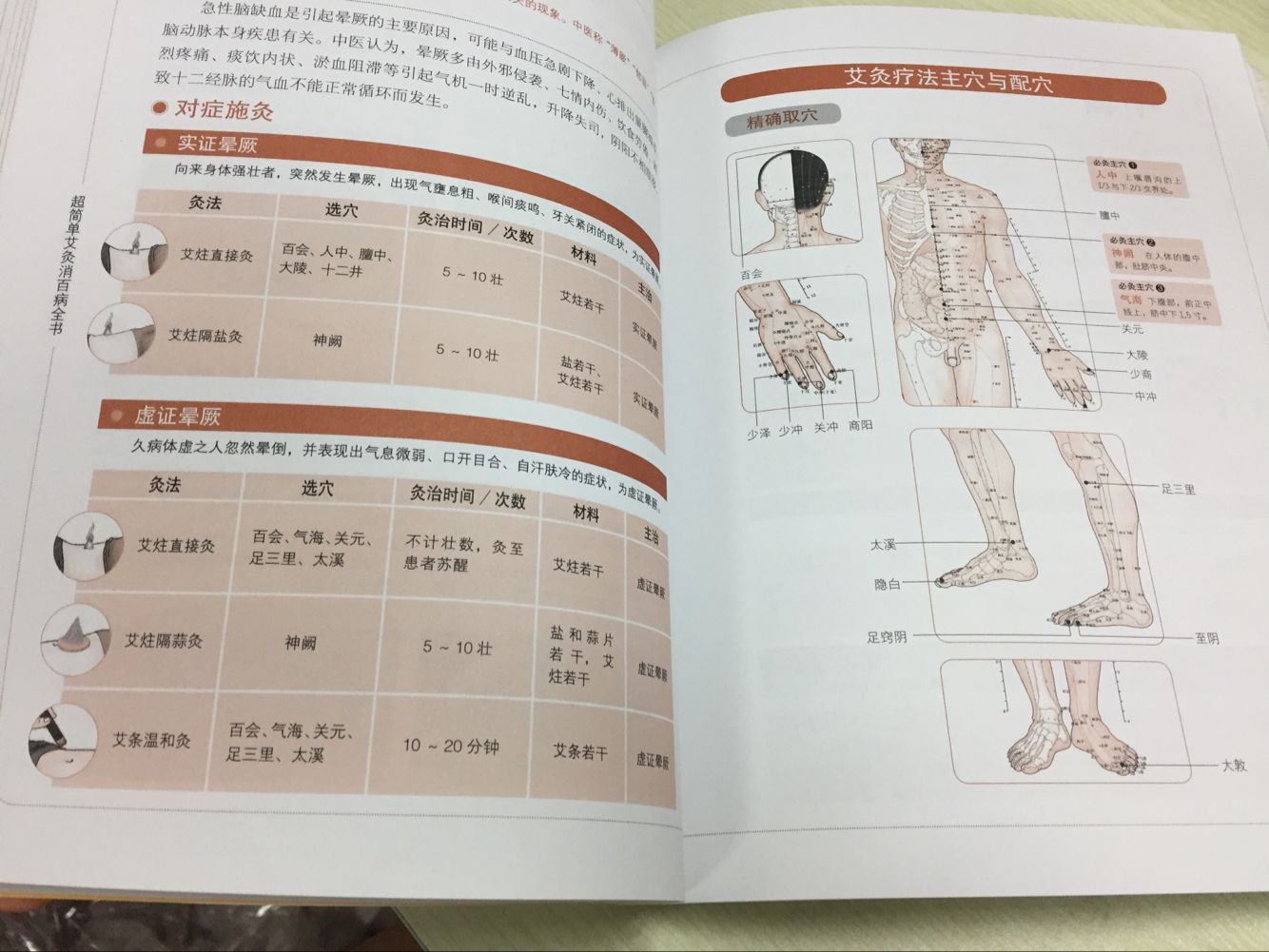 正版包邮 chao简单艾灸消百病全书 实用的家庭常备健康宝典书籍 中医养生 817幅插画精解 速查全图解健康养生堂ph