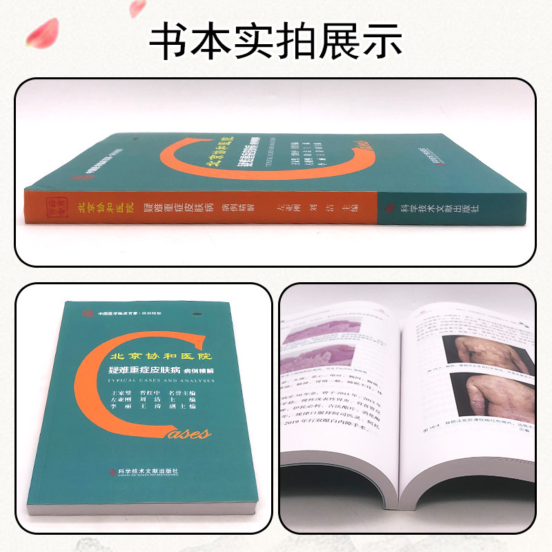 北京协和医院疑难重症皮肤病自身 久久旺图书皮肤病学/性病学