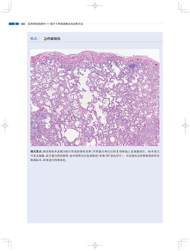 实用肺部病理学基于6种病理模式的诊断方法史景云上海科学技术出版社供病理科医生肺科医生阅读参考影像医学病理学-图1