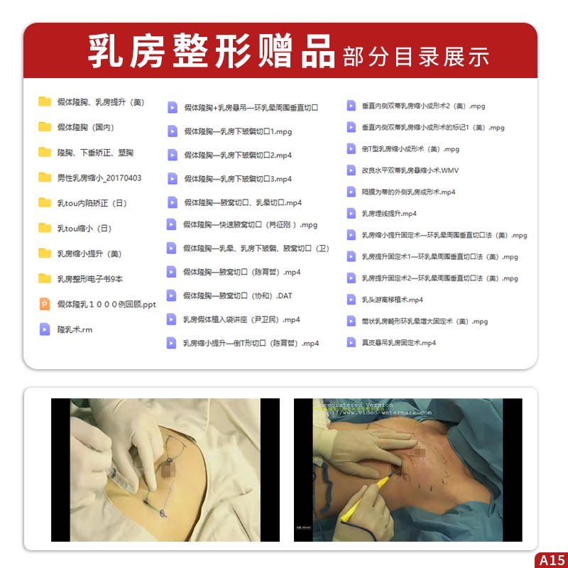 乳房美容外科学+breast手术+图谱 久久旺图书外科学