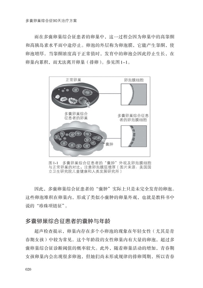 多囊卵巢综合征90天治疗方案 凝聚20年临床研究前沿成果 多囊卵巢患者推荐阅读 正版书籍 多囊卵巢综合征调理书完全指南月经不调症