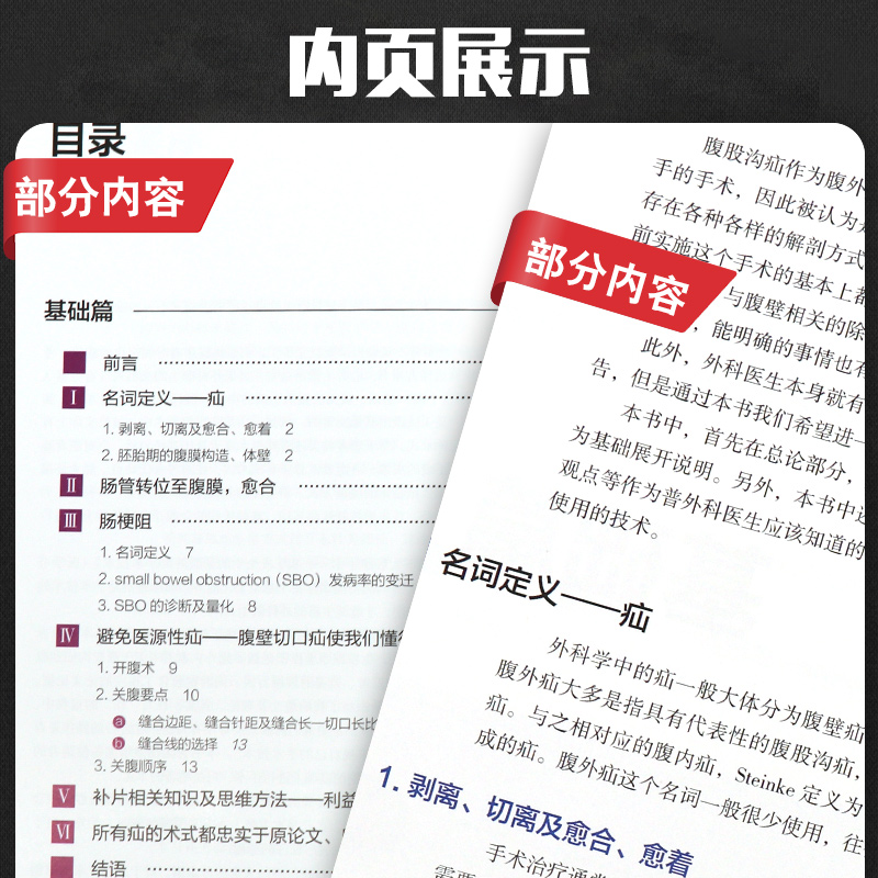 正版图解疝手术的基础与要点(日)三毛牧夫主编筋膜解剖医学外科学书籍腹股沟股疝治疗方法辽宁科学技术出版社9787559110916-图2