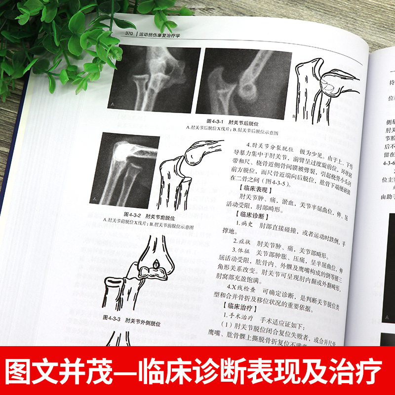 运动损伤康复治疗学第二2运动损伤的临床治疗康复热点及其临床应用价值新兴的音乐治疗竞技运动康复运动系统外骨骼机器人放射医学