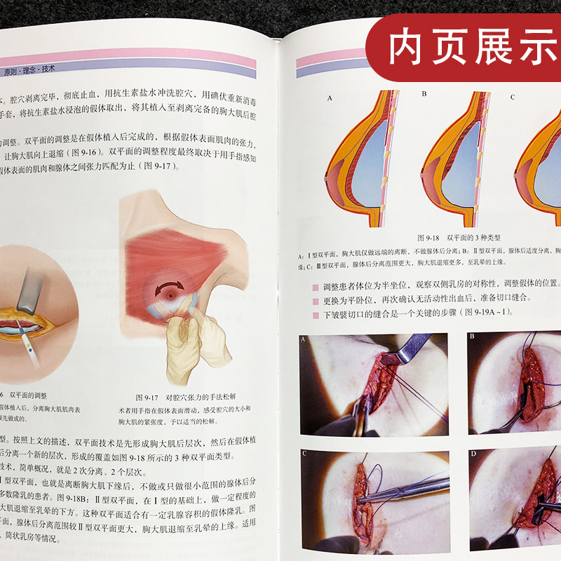 乳房美容外科原则理念技术曾昂书籍 久久旺图书外科学