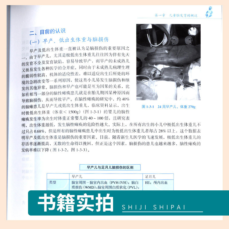 儿童脑发育早期干预训练图谱+儿童感知运动活动指导+儿童运动发育迟缓康复训练图谱 小儿神经发育治疗学少儿运动康复按摩经络拿书