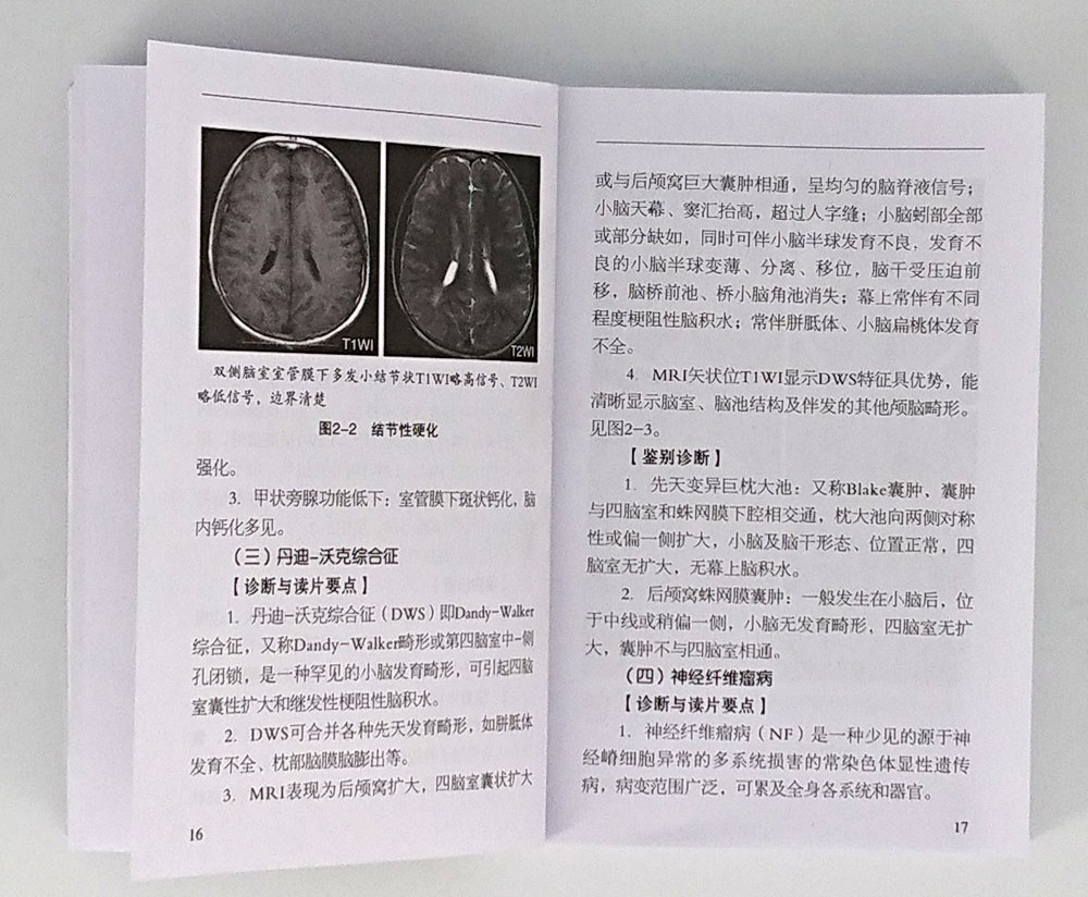 临床实用MRI掌中宝临床实用掌中宝系列第4本科学简明实用临床宝典便携小册子口袋书核磁共振诊断学影像诊断学影像解剖图谱书籍-图2