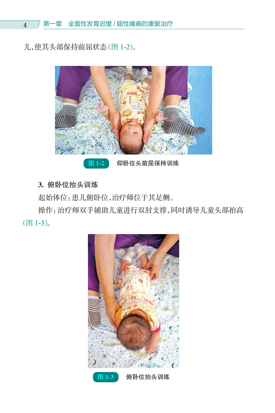 儿童康复治疗图解 肖农 刘玲主编 儿童康复部位及运动能区各部分梳理流程图指导应用 操作目的要点易错点 典型案例 人民卫生出版社