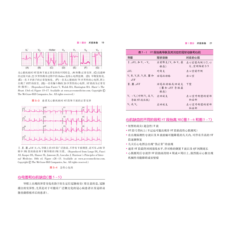 全2册临床麻醉实用指南上下册 王国林主译 心胸外科神经外科儿科妇产科重症监护麻醉学医师工具书 现代摩根麻醉学临床病案分析书籍 - 图3