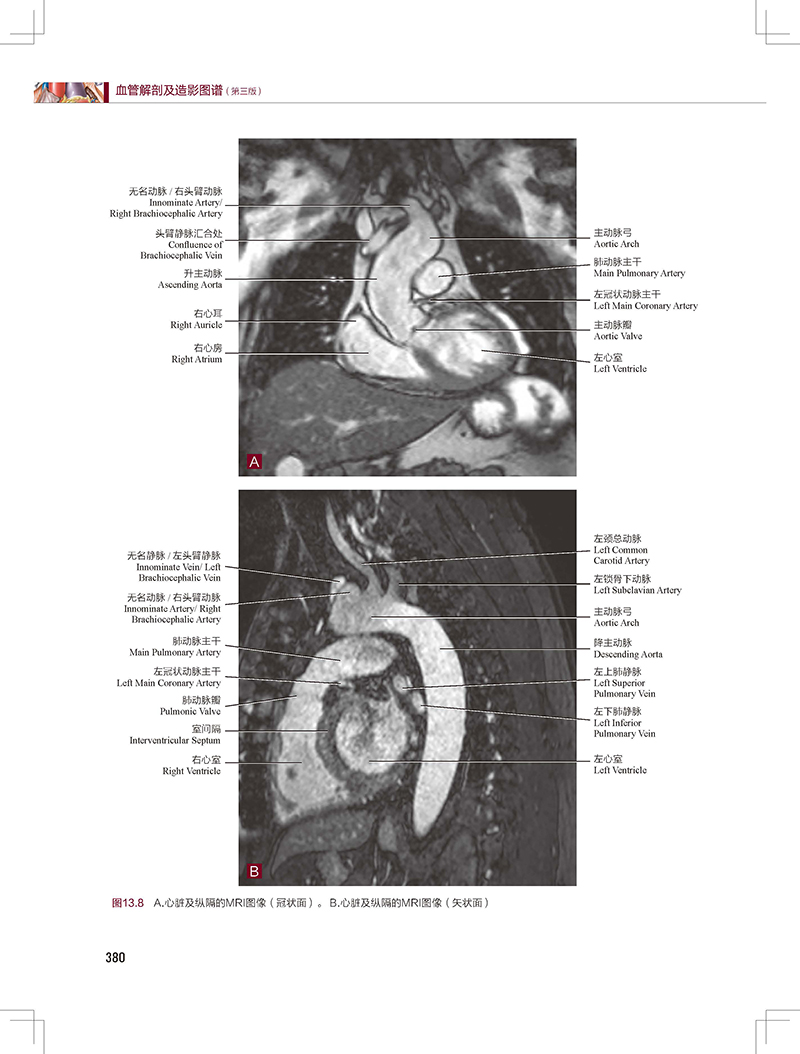 血管解剖及造影图谱 第3版 陶晓峰 董伟华 主译 血管介入治疗解剖学基础 临床操作陷阱 DSA造影 北京科学技术出版社9787571426507