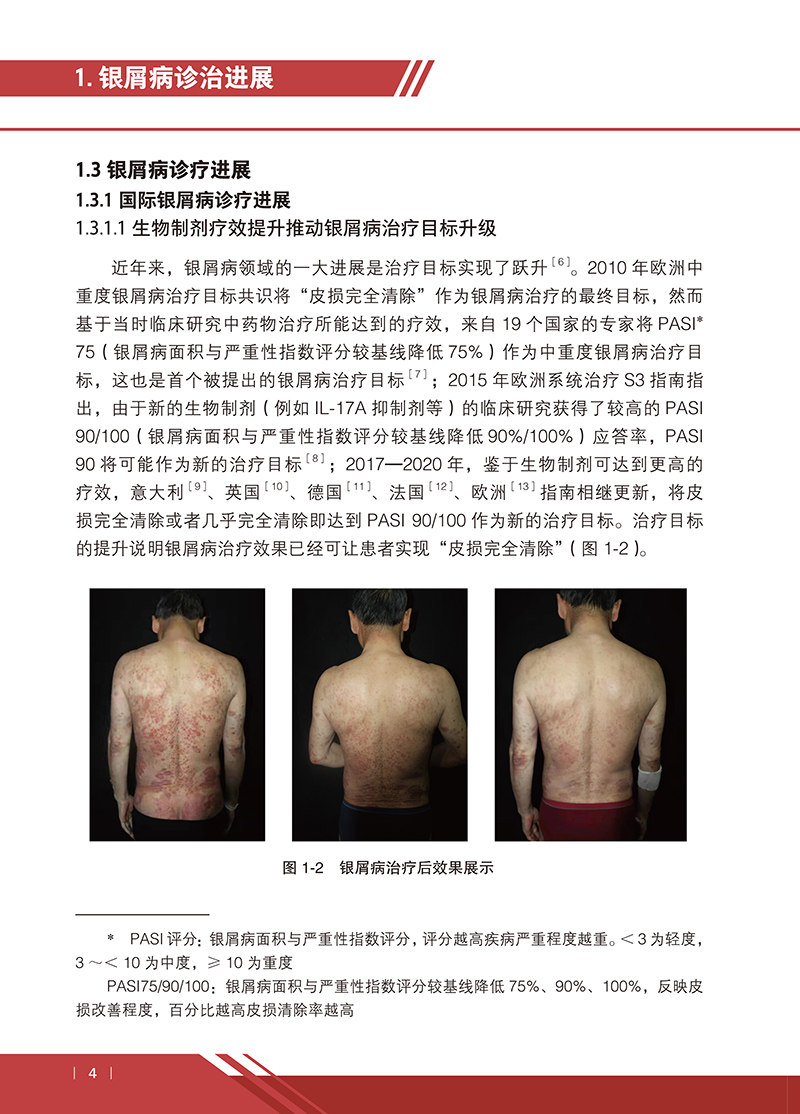 中国银屑病诊疗现状2020蓝皮书李航 文琳图书音像皮肤病学/性病学