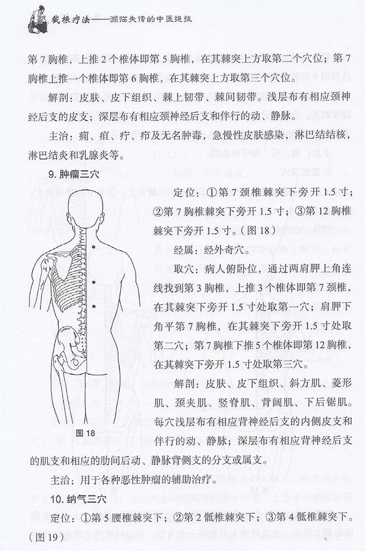 截根疗法濒临失传的绝技中医学书籍 文琳图书音像中医