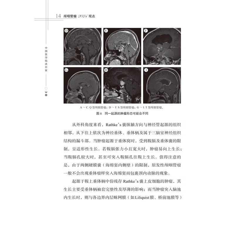 颅咽管瘤2024观点 主编 漆松涛 刘忆 颅咽管瘤命名的演变及分类 神经病学与精神病学 医学书籍 科学技术文献出版社9787523517192