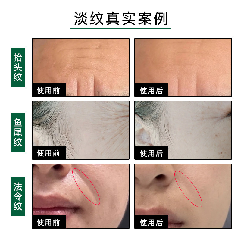德国佰奥德BIOMD焕龄时光童颜油30ml面部K皱淡纹紧致提亮抗光老 - 图2