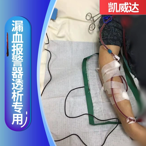 Кайвейда больница диализис испарение кровь. Аварийный сигнал кровь падение умного напоминания.