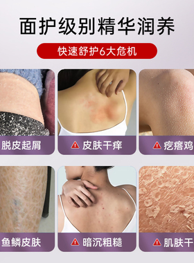 烟酰胺身体乳滋润肌肤