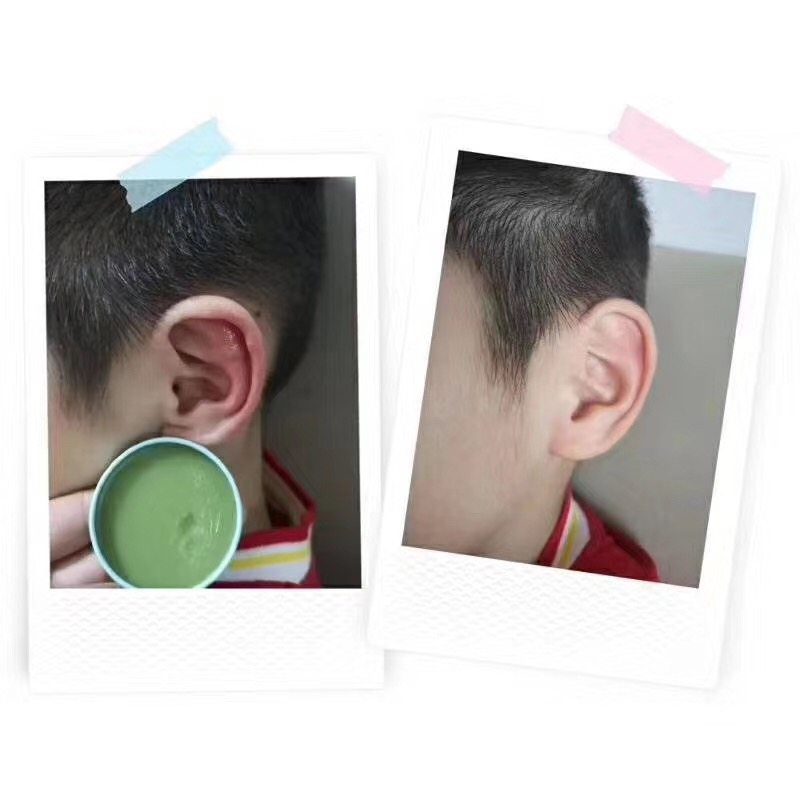 SOLOVE米菲婴儿童多效植物修复膏孕妇宝宝驱蚊消包止痒红pp紫草膏,淘宝优惠券,粉丝福利购,淘宝优惠卷