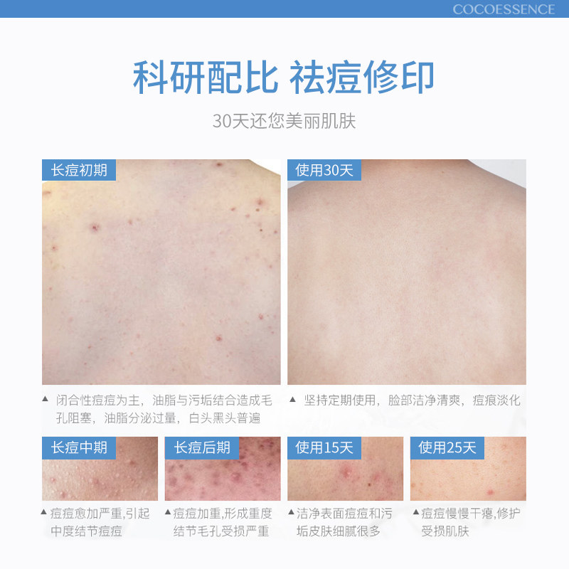 后背部除螨虫磨砂膏全身沐浴盐 遇见香芬化妆品浴盐