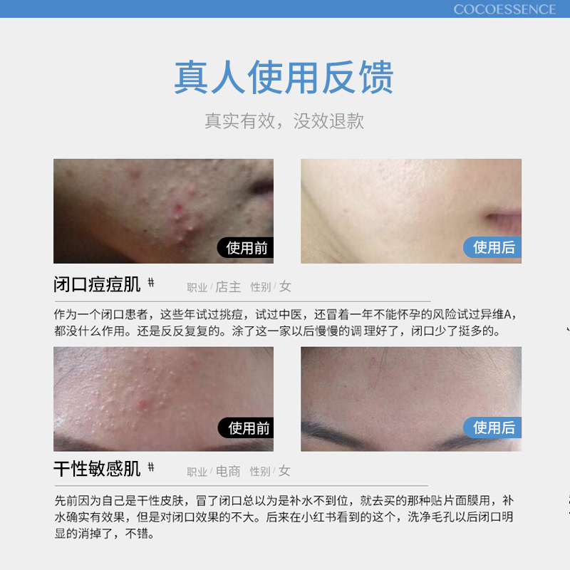 遇见香芬面部祛痘套装油痘肌水乳护肤洗面奶控油非去痘印螨虫膏 遇见香芬面部祛痘套装油痘肌水乳护肤洗面奶控油非去痘印螨虫膏