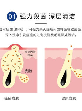 meishoku明色洁面皂祛痘皂80g