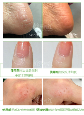 dunalla鳄鱼油多效霜护手霜