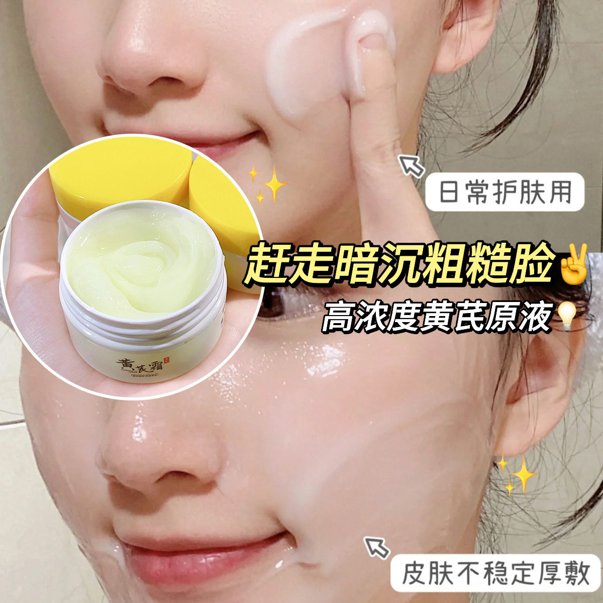 Astragalus cream improves dark yellow skin and moisturizes it