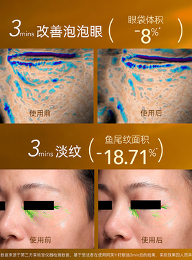 【阿芙权杖眼油】10ml到手14ml