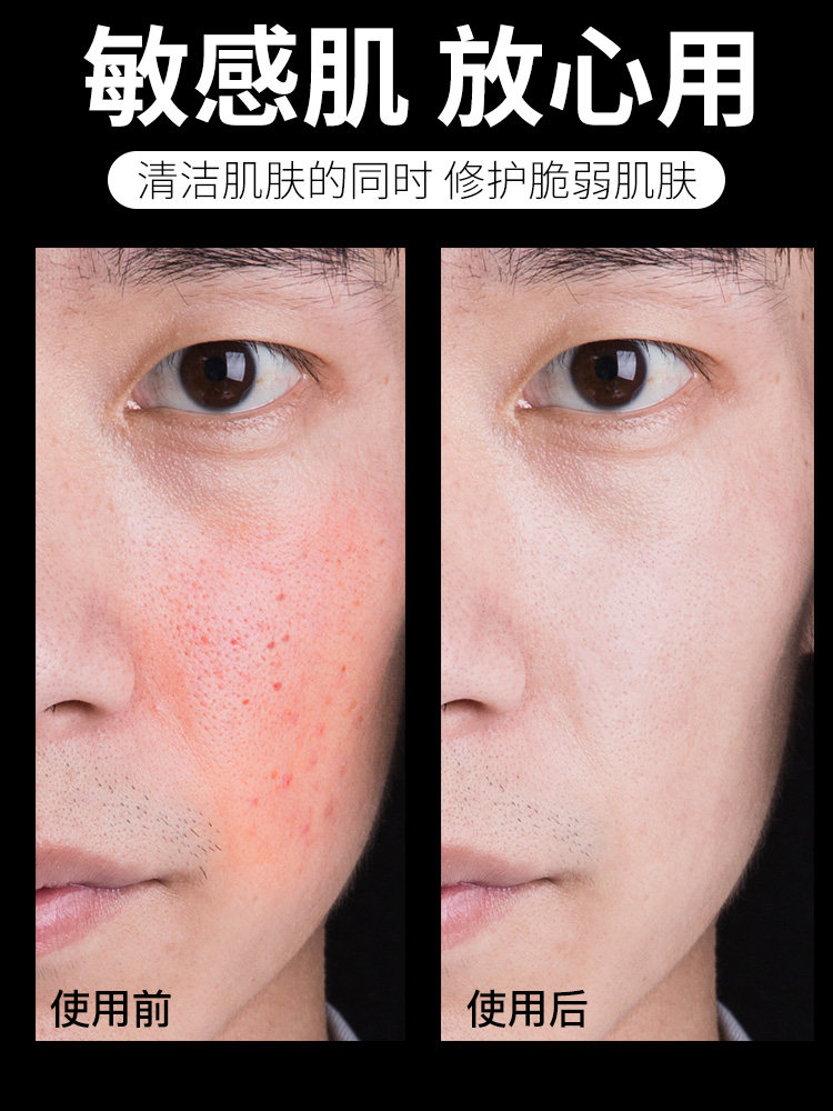 曼秀雷敦洗面奶男士专用抗痘氨基酸 曼秀雷敦美妆男士洁面