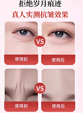 去皱眉间川字纹贴额头贴神器法令纹贴提拉改善眼角皱纹抬头纹紧致