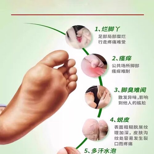 碘伏搭治脚气大瓶消毒液泡脚臭汗脱皮专用非医用去典真菌灰指甲er - 图1