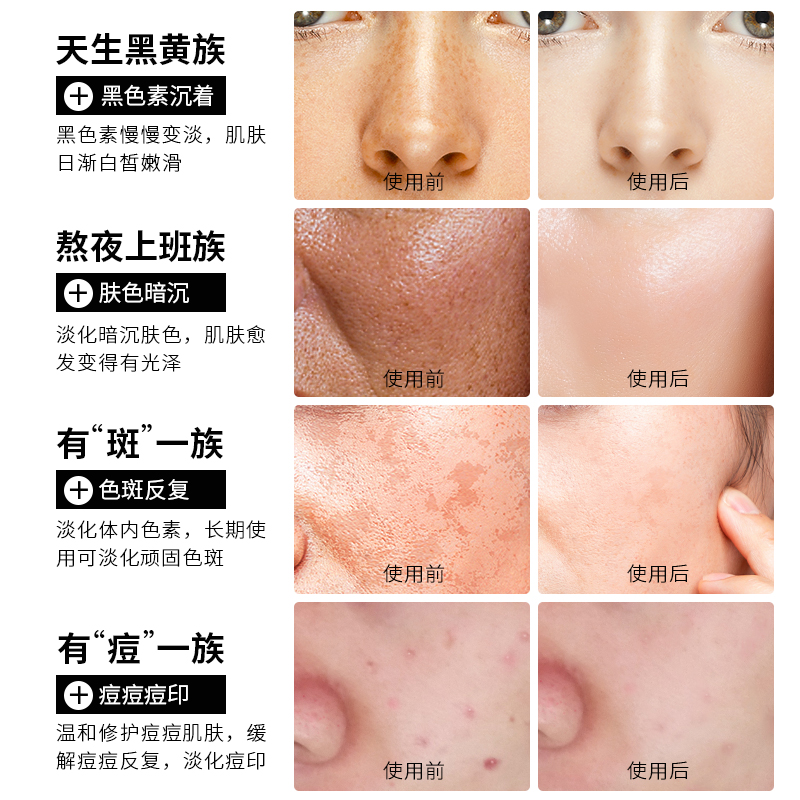 资莱皙旗舰店淡斑美白烟酰胺小安瓶精华液面部精华收缩毛孔补水保湿玻尿酸原液1