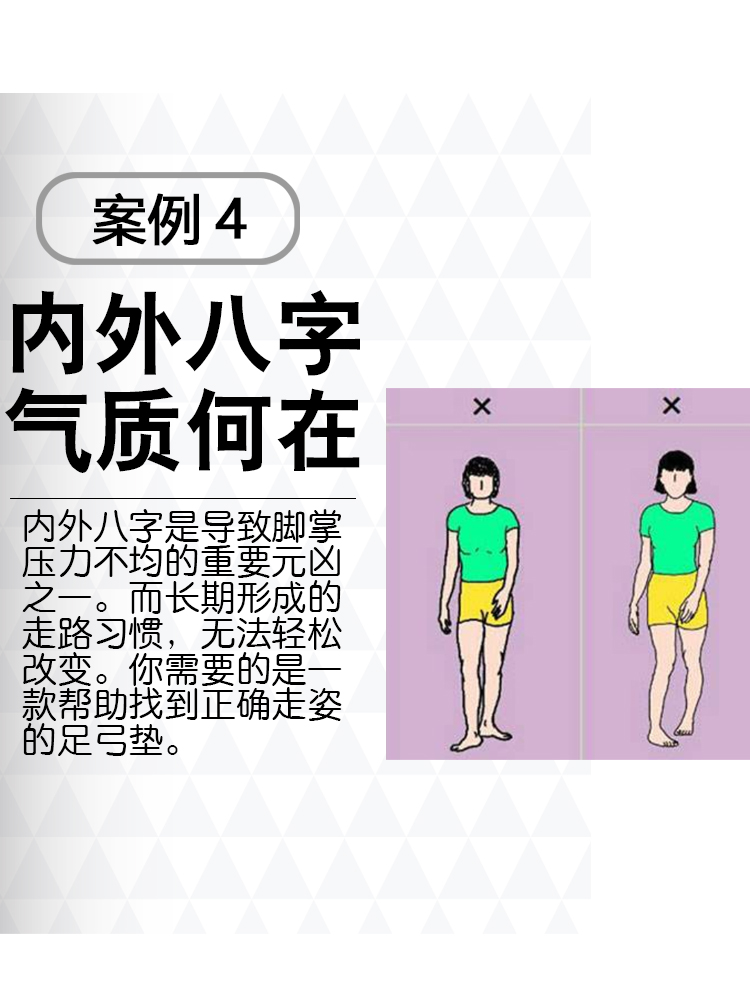 扁平足矫正鞋垫xo型腿足底矫足外翻高足弓垫纠正脚器儿童训练小腿 - 图2