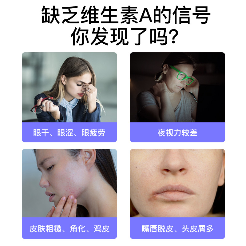 普丽普莱维生素a β-胡萝卜素软胶囊亮眼睛去鸡皮呵护双眼护眼 - 图0