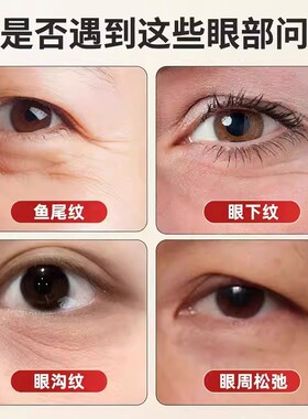 朱雀三啄工具羊角小莲蓬眼部按摩棒双头拨筋点穴笔面部美容拨筋棒