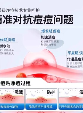 星星痘痘贴痘印贴人工皮水胶体敷料吸脓可上妆可爱豆豆遮瑕祛痘贴