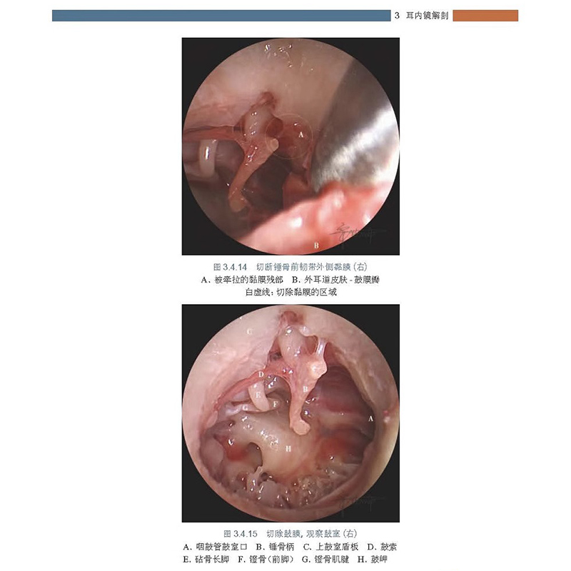 耳内镜解剖图谱为广大初中高医师和在校医学生学耳内镜解剖提供参考耳鼻喉科学宋跃帅龚树生著 9787117308854人民卫生出版社-图0