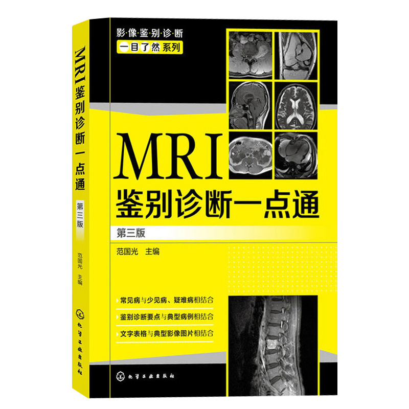 MRI鉴别诊断一点通 mri影像诊断mri诊断与临床mri基础mri检查技术医学影像诊断学医学影像学读片诊断图谱导图式医学影像鉴别诊断书-图3