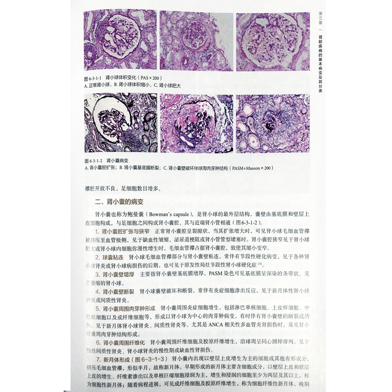 肾脏病学第4版 第四版王海燕赵明辉临床肾脏病学进展肾脏疾病诊治疗法病理生理学肾内科医师血透室医生工具参考书籍人民卫生出版社 - 图0