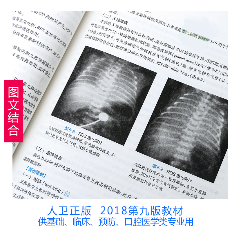 新版儿科学第9版王卫平孙锟常立文主编全国十三五本科临床规划教材第九版人卫版内科学生理病理学诊断学神经病人民卫生出版 10-图2