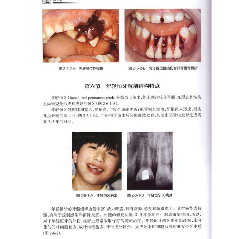 牙外伤第2版第二版牙外伤教科书口腔科学口腔科医师学习参考工具书供口腔外科全科医生牙医门诊临床书籍人民卫生出版社龚怡_虎窝淘