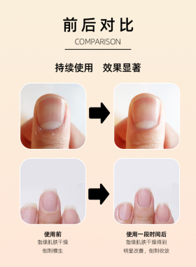 美国cuccio指甲营养油笔倒刺
