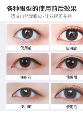 蕾丝双眼皮贴女隐形自然肿眼泡内双眼皮神器无痕隐形遇水即粘美目