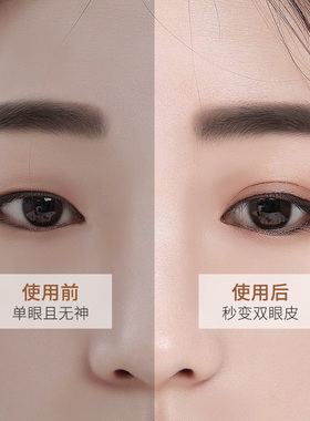 双眼皮贴女双面拉线肿眼泡自然