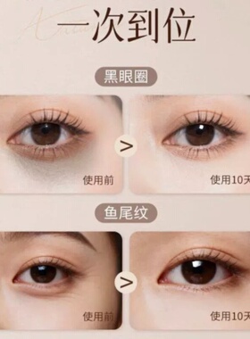 小莲蓬铜珠按摩器提拉眼皮眼角