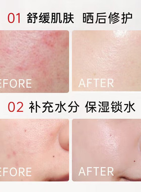 日本去红血丝舒缓修护敏感肌面霜