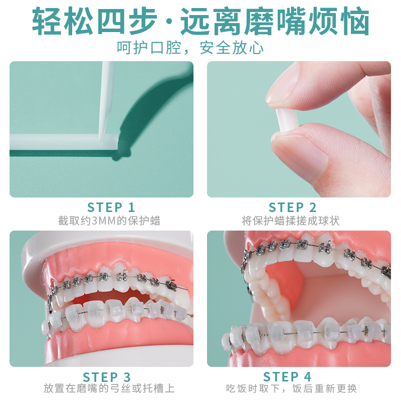 素浴正畸保护蜡托槽矫正牙齿专用牙箍腊口腔黏膜防磨嘴牙套食用蜡