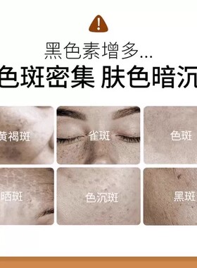 祛斑美白淡黄褐雀睡眠面膜